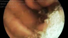 Medical exam in hospital video of medical endoscopy in full screen 720hd mp4