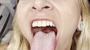 Mouth and Throat Showcase