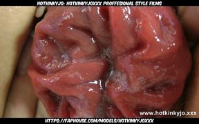 Hippie babe gets huge plug in ass and prolapse fun