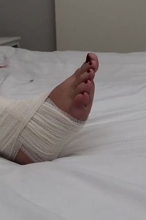 I Sprained My Ankle! by Kinkylyrical