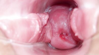 Cervix Display and Speculum Play