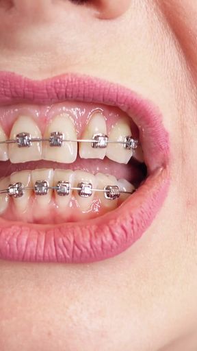 Must-see moment from &quot;ASMR video: hot BRACES and double layer of medical nurse nitrile gloves (Arya Grander)&quot;