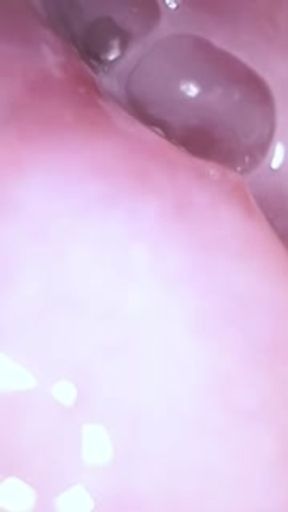 Omanko Endoscope