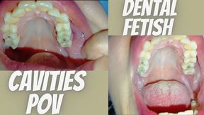 Pov. Crooked and decayed teeth
