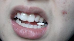 Aurora Teeth With A Mint