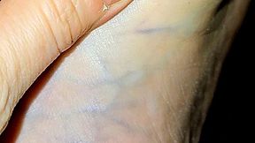 POV: Arch Pressure and Vein Flow