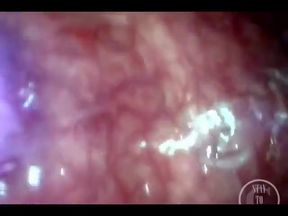POV Extreme Deep Anal Exploration! Fast Visible Heartbeat