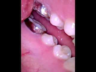 Vore video