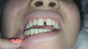 Showing My Perfect Teeth.