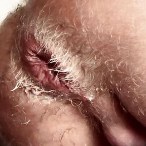 DESTROYING MY HOLE HARDCORE ANAL FIST WITH SPIT AND BOTTOOMCUM