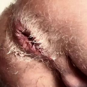 DESTROYING MY HOLE HARDCORE ANAL FIST WITH SPIT AND BOTTOOMCUM