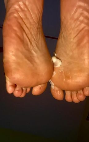 Lotion on sore soles 🦶🏻🧴