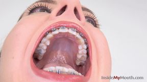 Inside My Mouth - Jennifer - Dental braces clip! (4K quality)