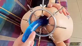 Anal Fist And Prolapse