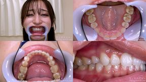 Yuri Adachi - Watching Inside mouth of Japanese cute girl - 1080p