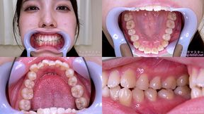 Akari Hanazato - Watching Inside mouth of Japanese cute girl - MOV