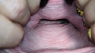 Cervix close up [4k]