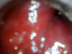anal endoscope ass play from inside