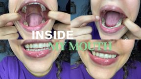 INSIDE MY MOUTH